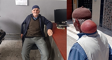 Yaklaşık İki Kiloluk Yağ Bezesi (Lipom) Ameliyatı Gerçekleşti